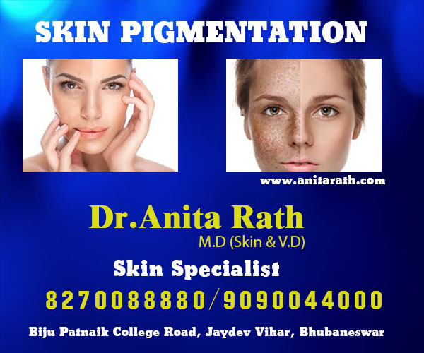 Best skin pigmentation treatment clinic in bhubaneswar near AIIMS hospital